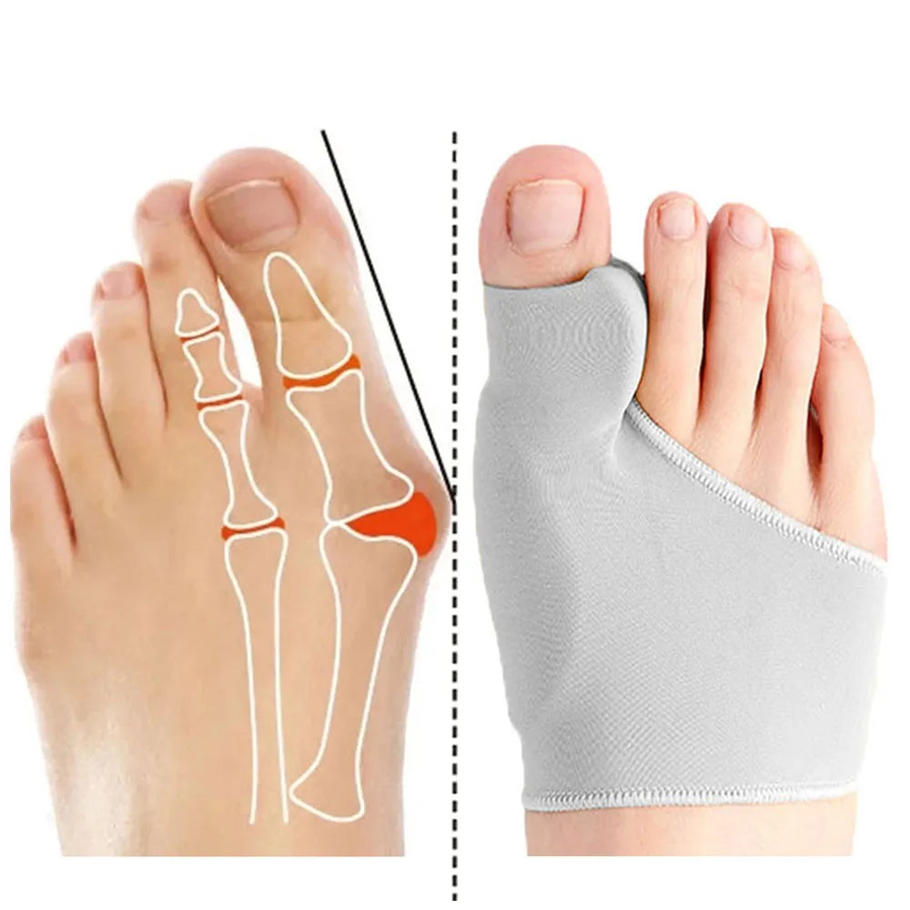 Low profile Bunion Corrector